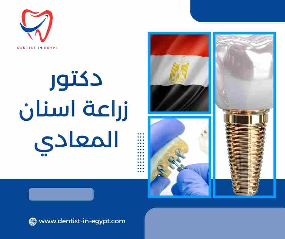 أفضل دكتور اسنان في المعادي