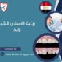 زراعة الاسنان الشيخ زايد