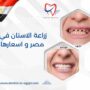 زراعة الاسنان في مصر و اسعارها