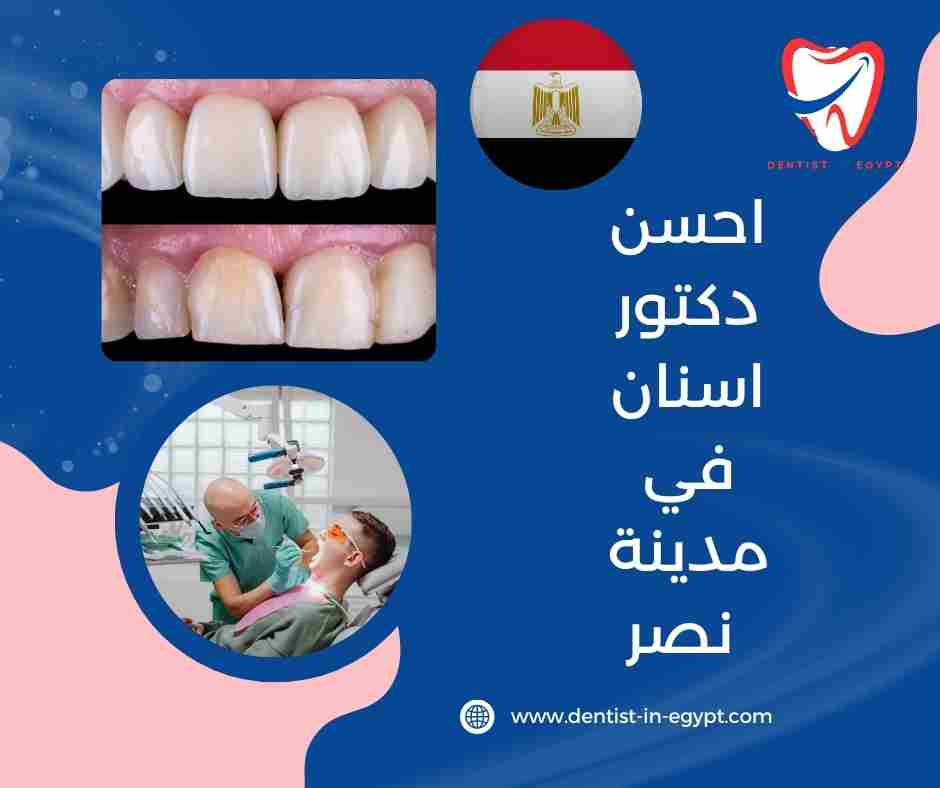 احسن دكتور اسنان في مدينة نصر