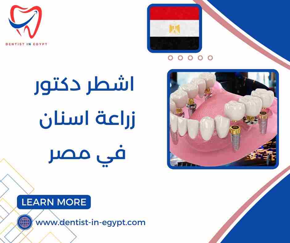 اشطر دكتور زراعة اسنان في مصر