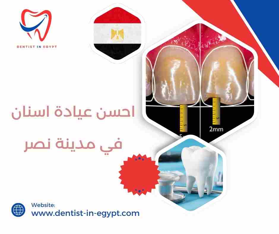 احسن عيادة اسنان في مدينة نصر