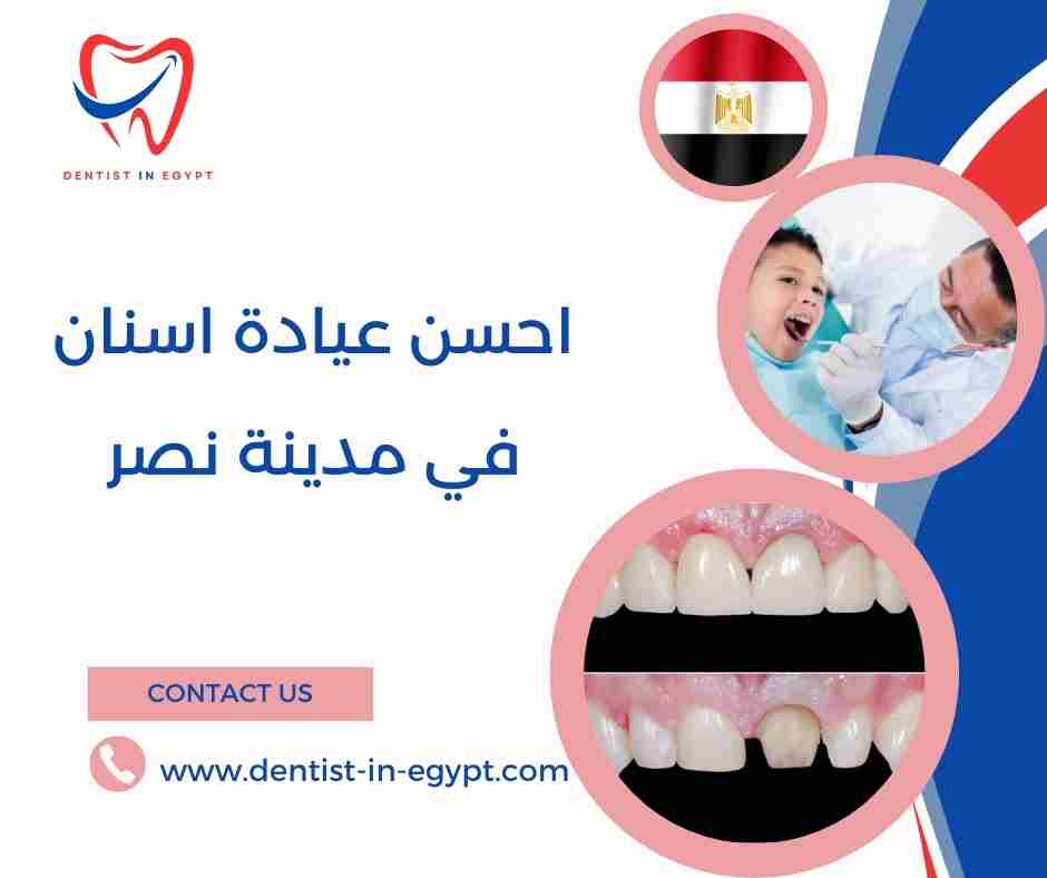 احسن عيادة اسنان في مدينة نصر