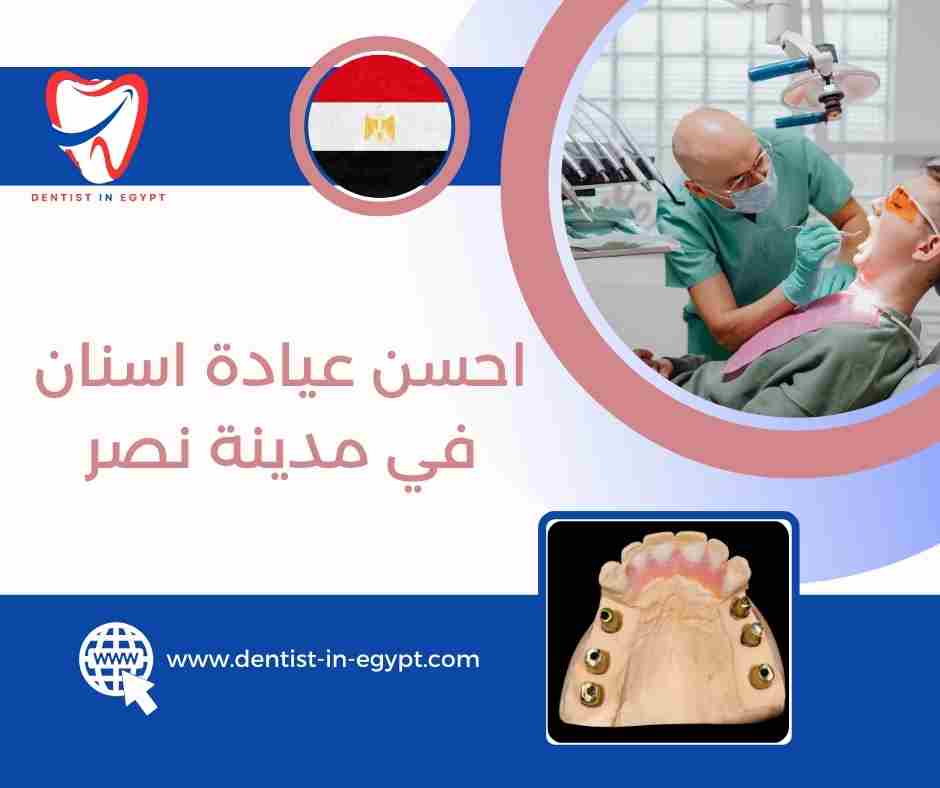احسن دكتور اسنان في مدينه نصر