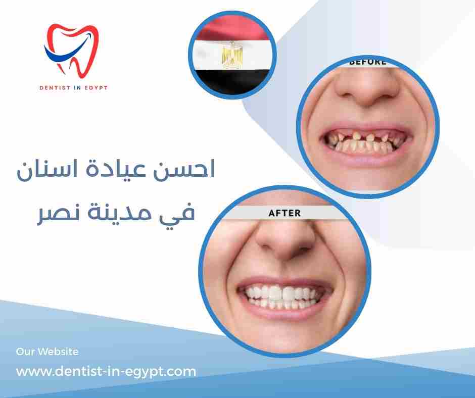 احسن عيادة اسنان في مدينة نصر