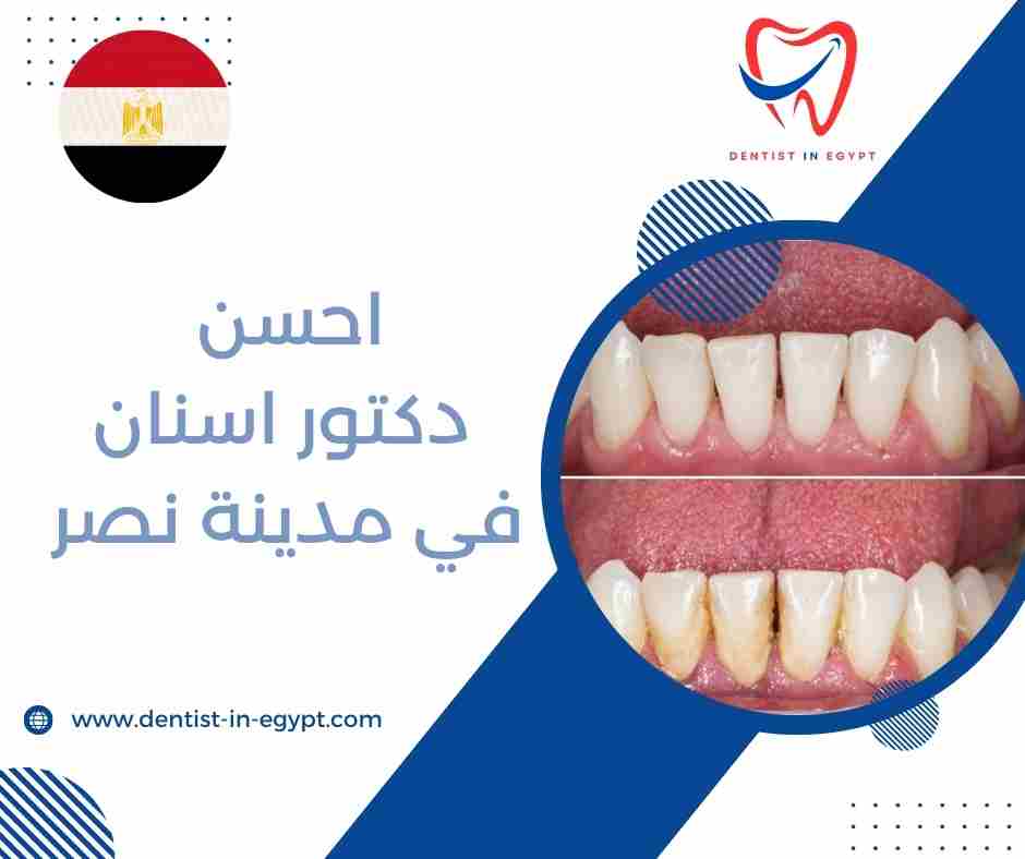 اشطر دكتور اسنان في مدينة نصر
