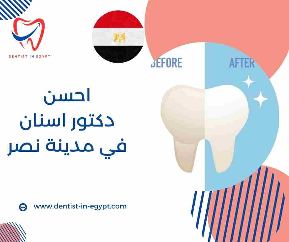 احسن دكتور اسنان في مدينه نصر