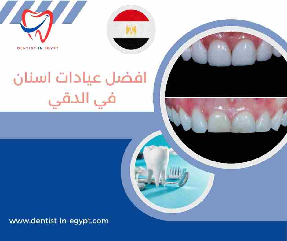  افضل عيادات اسنان في الدقي