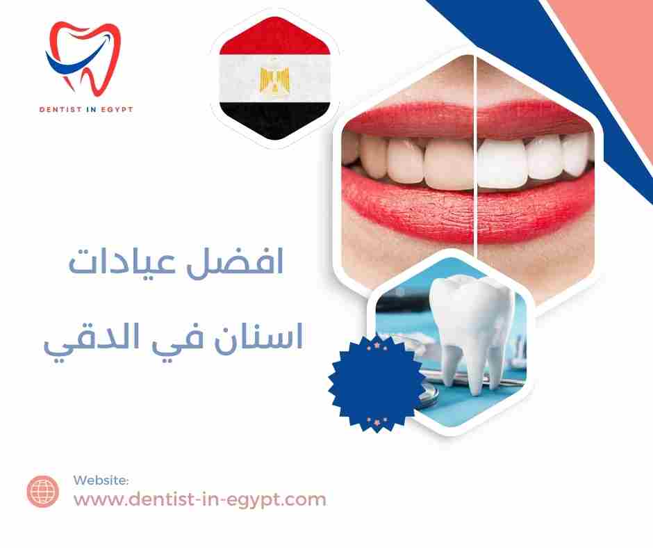  افضل عيادات اسنان في الدقي