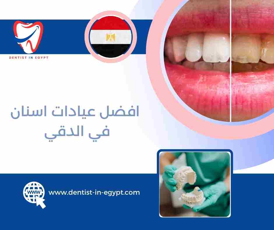  افضل عيادات اسنان في الدقي