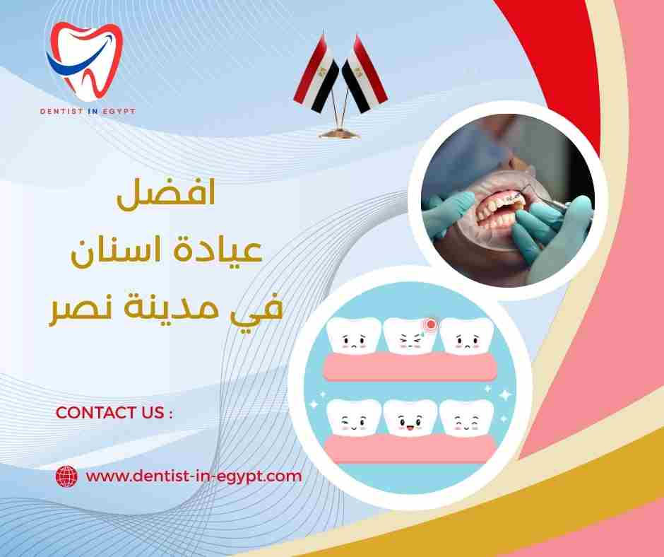 افضل عيادة اسنان في مدينة نصر