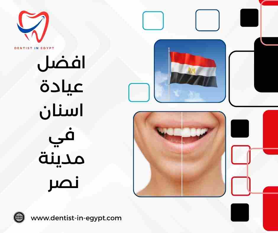 افضل عيادة اسنان في مدينة نصر