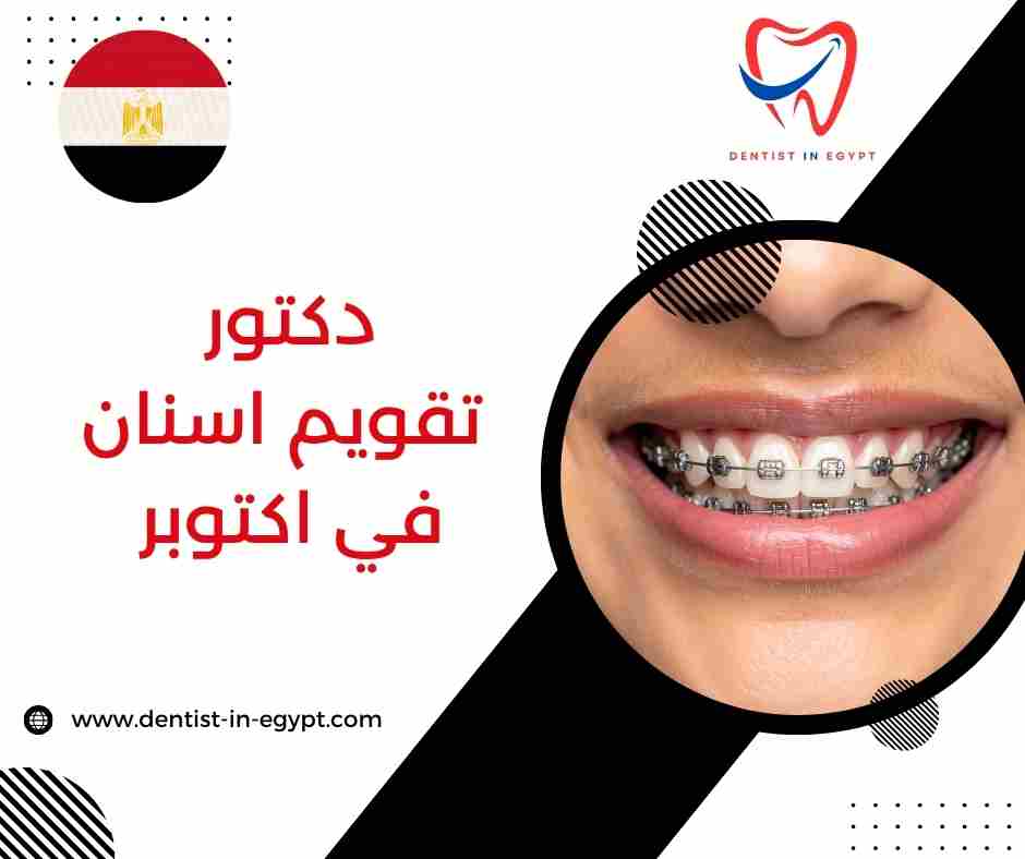 دكتور تقويم اسنان في اكتوبر