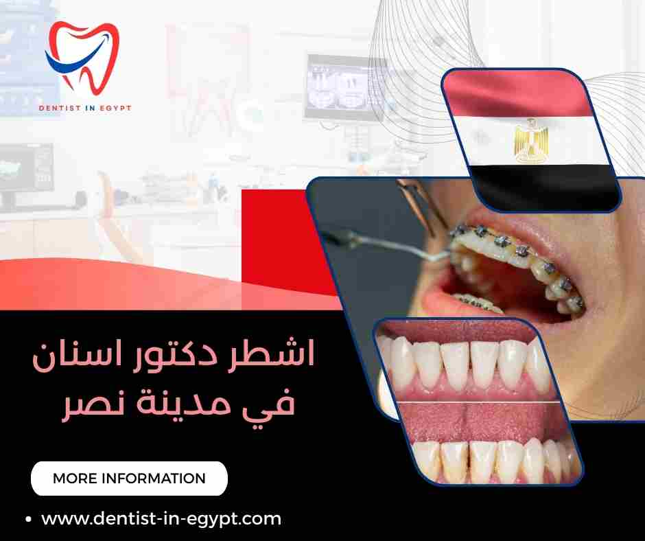 اشطر دكتور اسنان في مدينة نصر