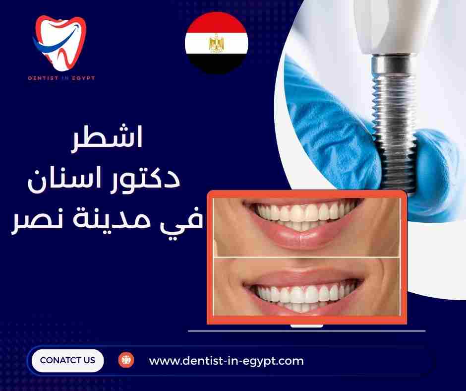 اشطر دكتور اسنان في مدينه نصر