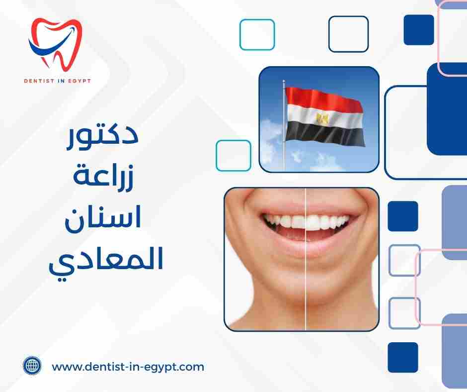 دكتور زراعة اسنان المعادي