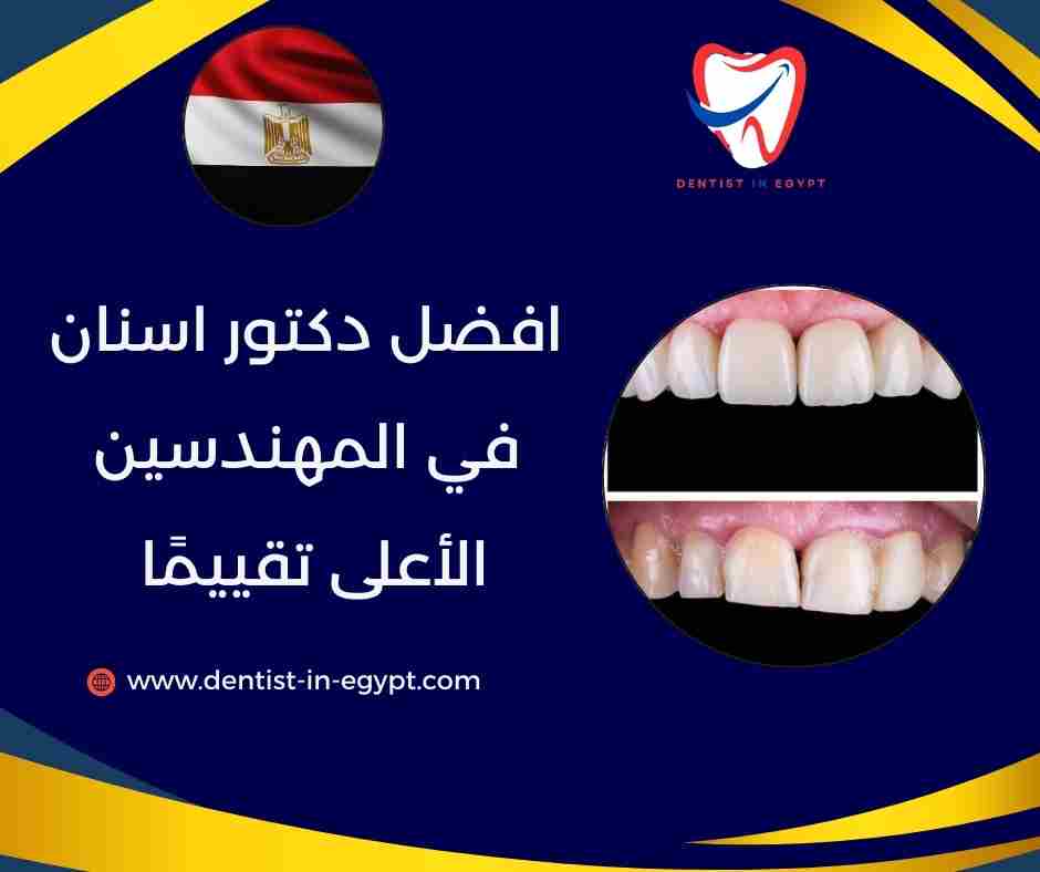 افضل دكتور اسنان في الدقي والمهندسين