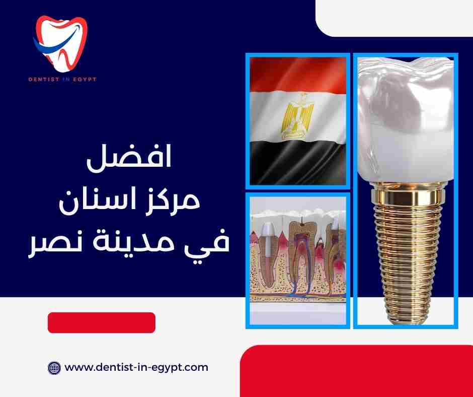 افضل مركز اسنان في مدينة نصر