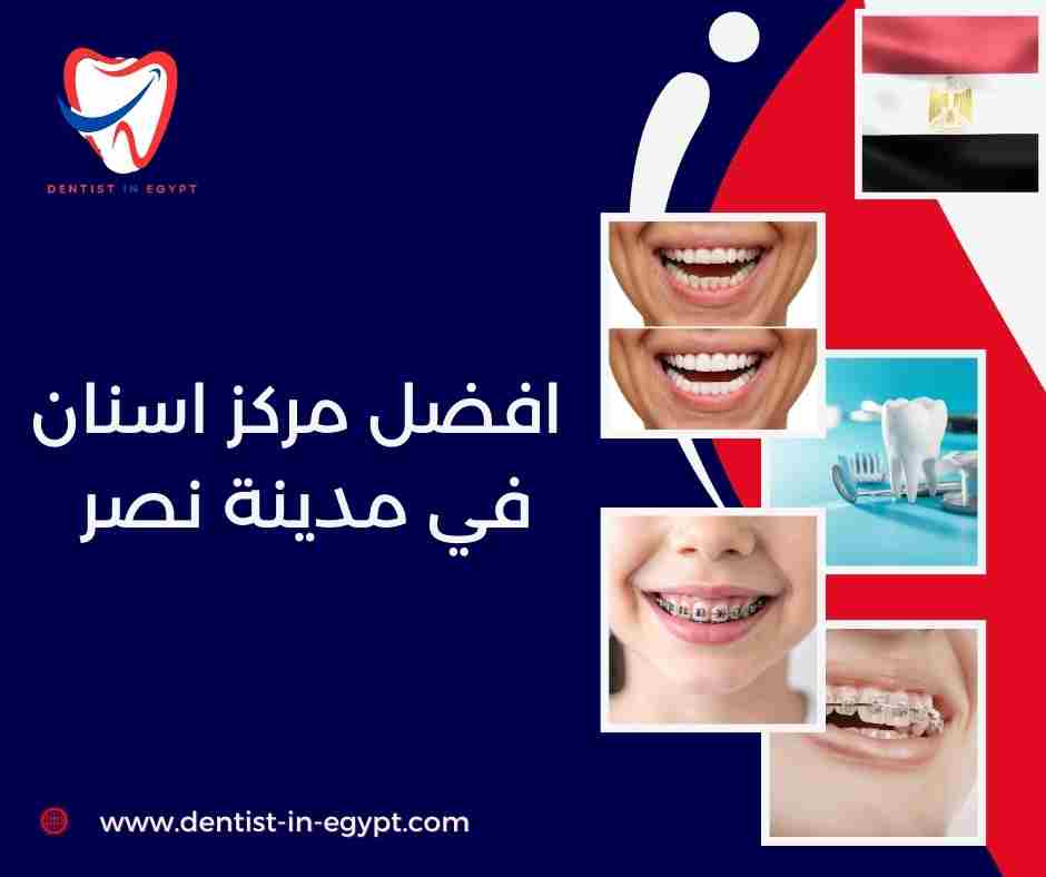 افضل مركز اسنان في مدينة نصر