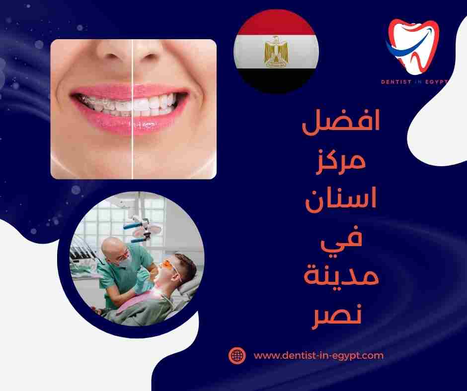 افضل مركز اسنان في مدينة نصر