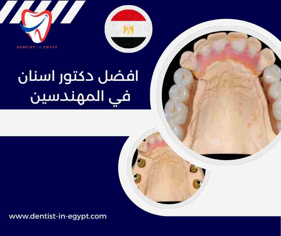 افضل دكتور اسنان في المهندسين