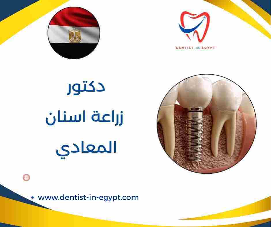 افضل دكتور اسنان في زهراء المعادي