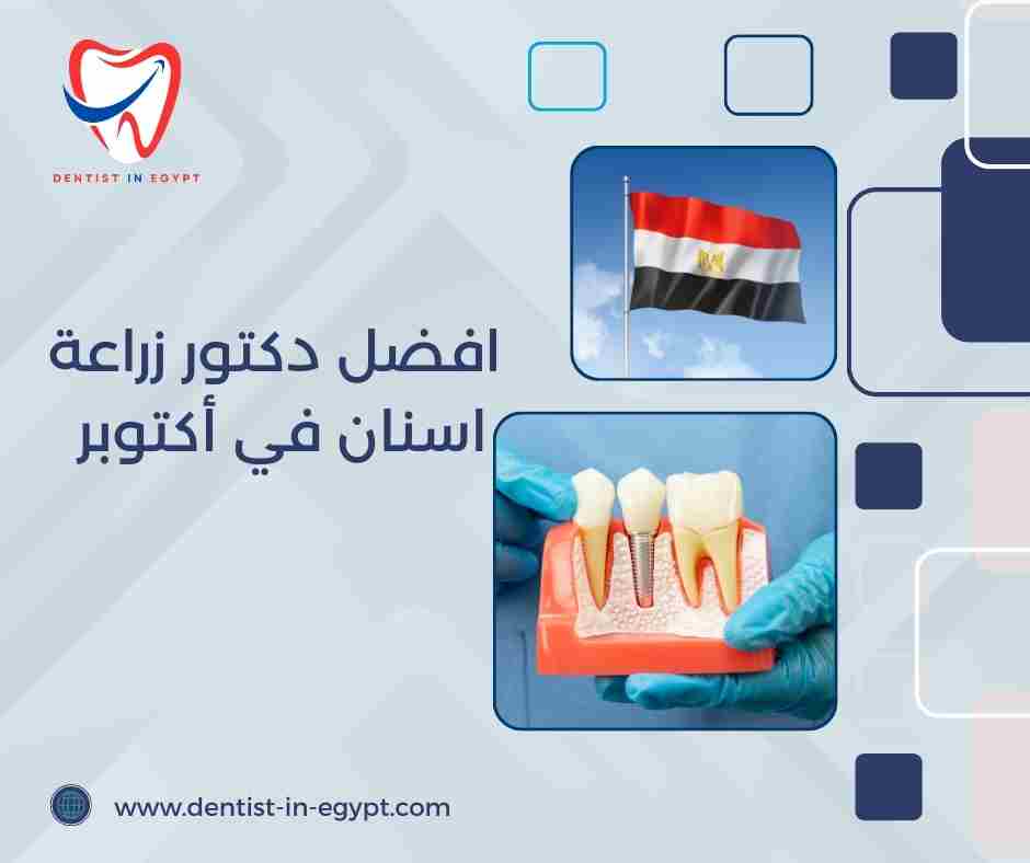 افضل دكتور زراعة اسنان في أكتوبر