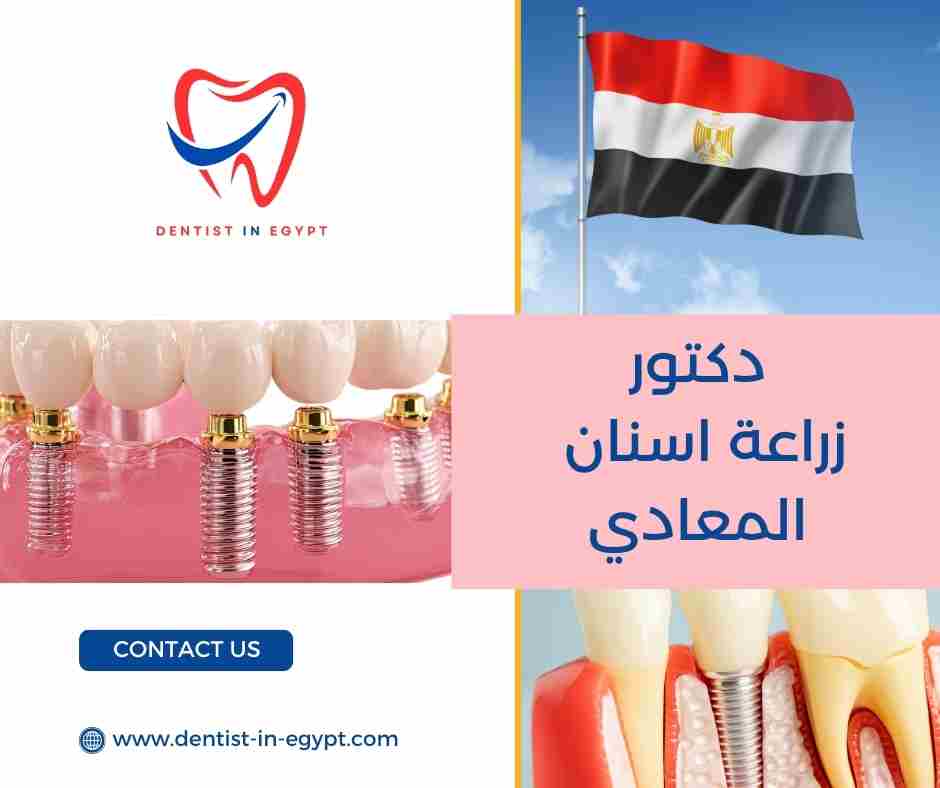 دكتور اسنان المعادى مفتوح الآن