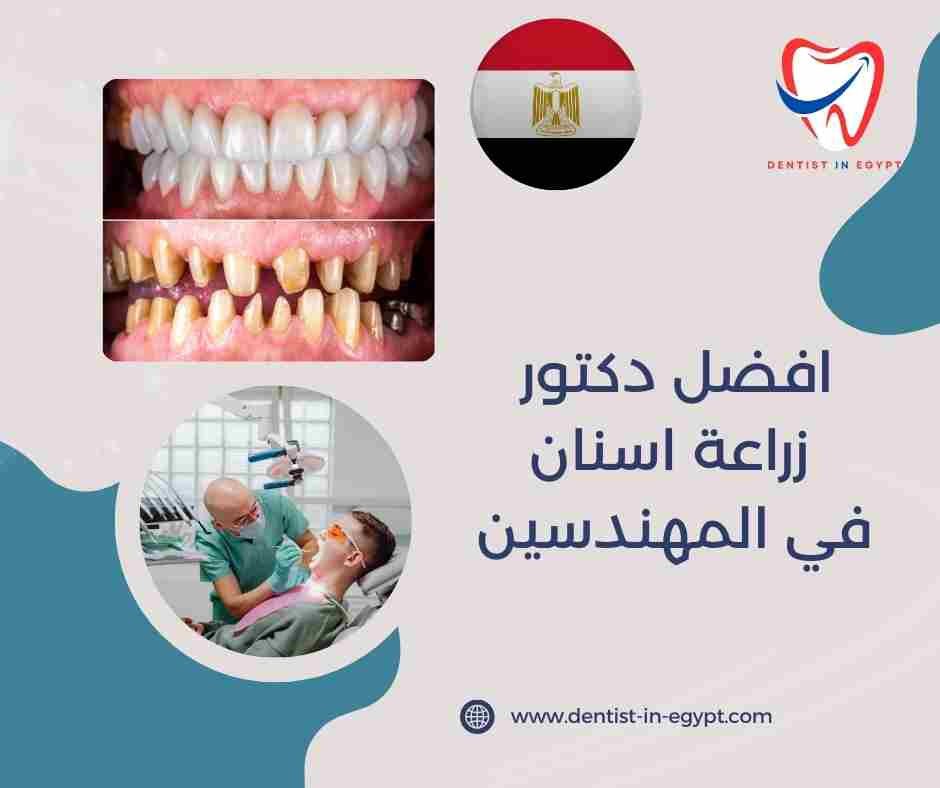 افضل دكتور زراعة اسنان في المهندسين