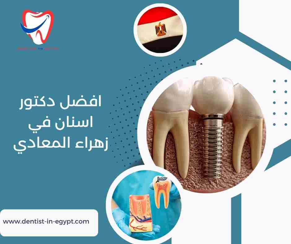 افضل دكتور اسنان في زهراء المعادي
