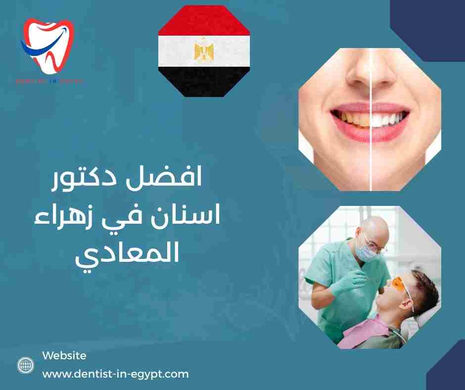 افضل دكتور اسنان في زهراء المعادي