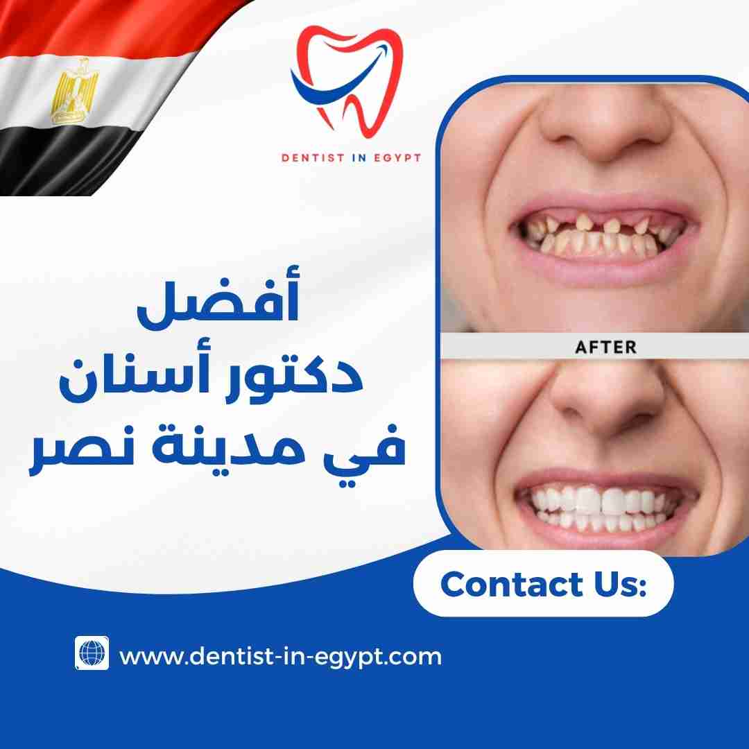 أفضل دكتور أسنان في مدينة نصر