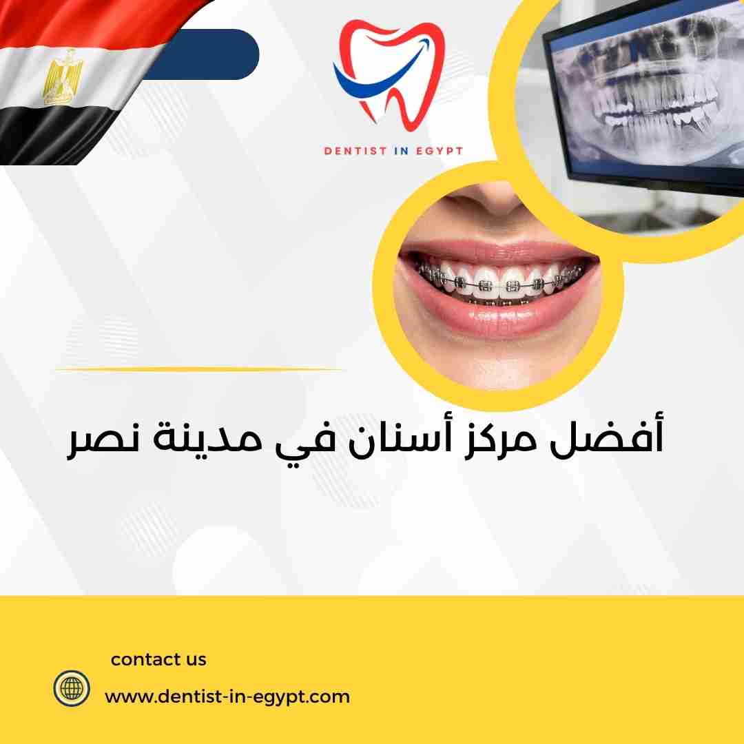 أفضل مركز أسنان في مدينة نصر