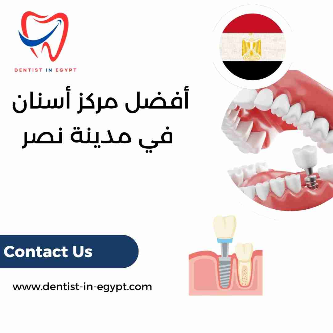 أفضل مركز أسنان في مدينة نصر