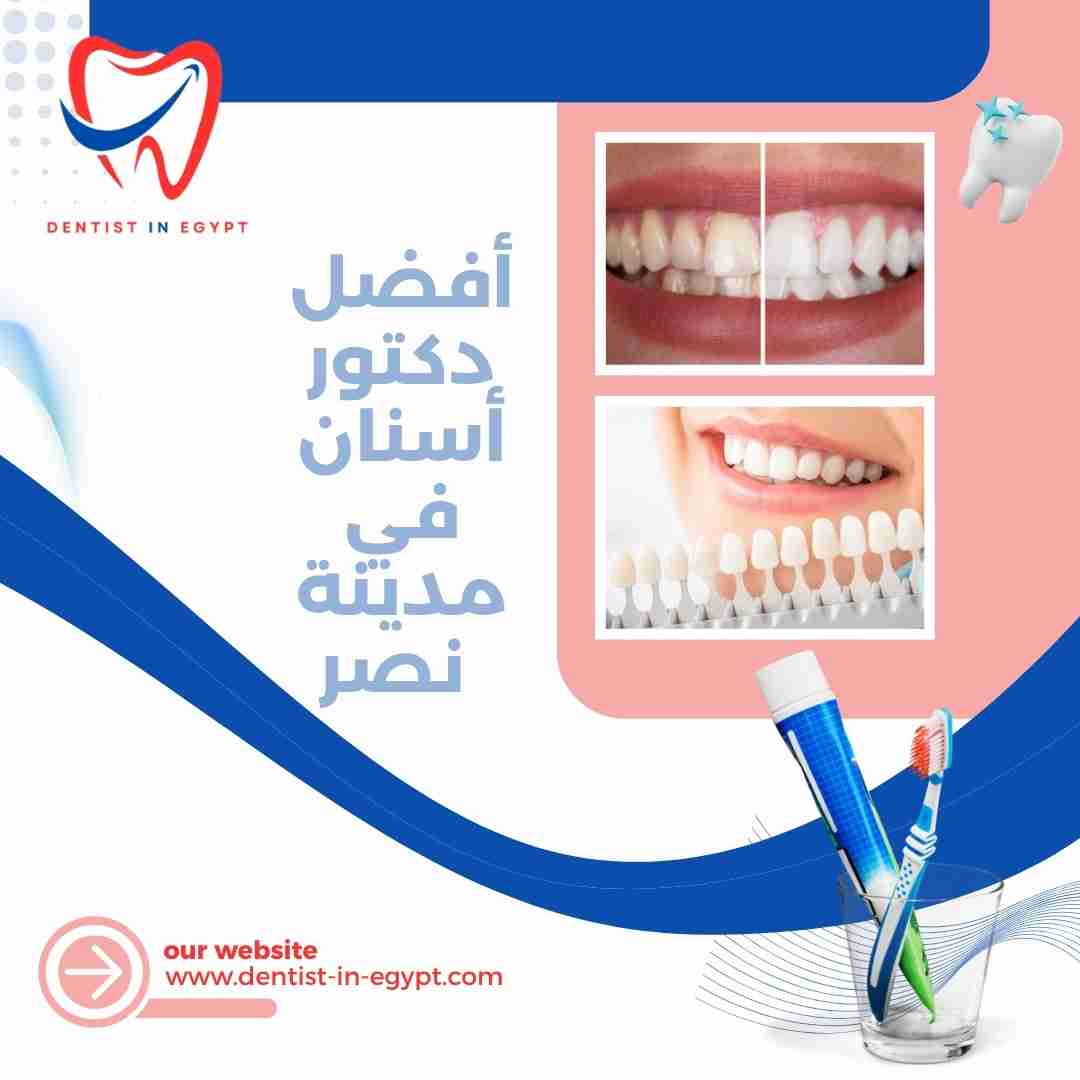 أفضل دكتور أسنان في مدينة نصر