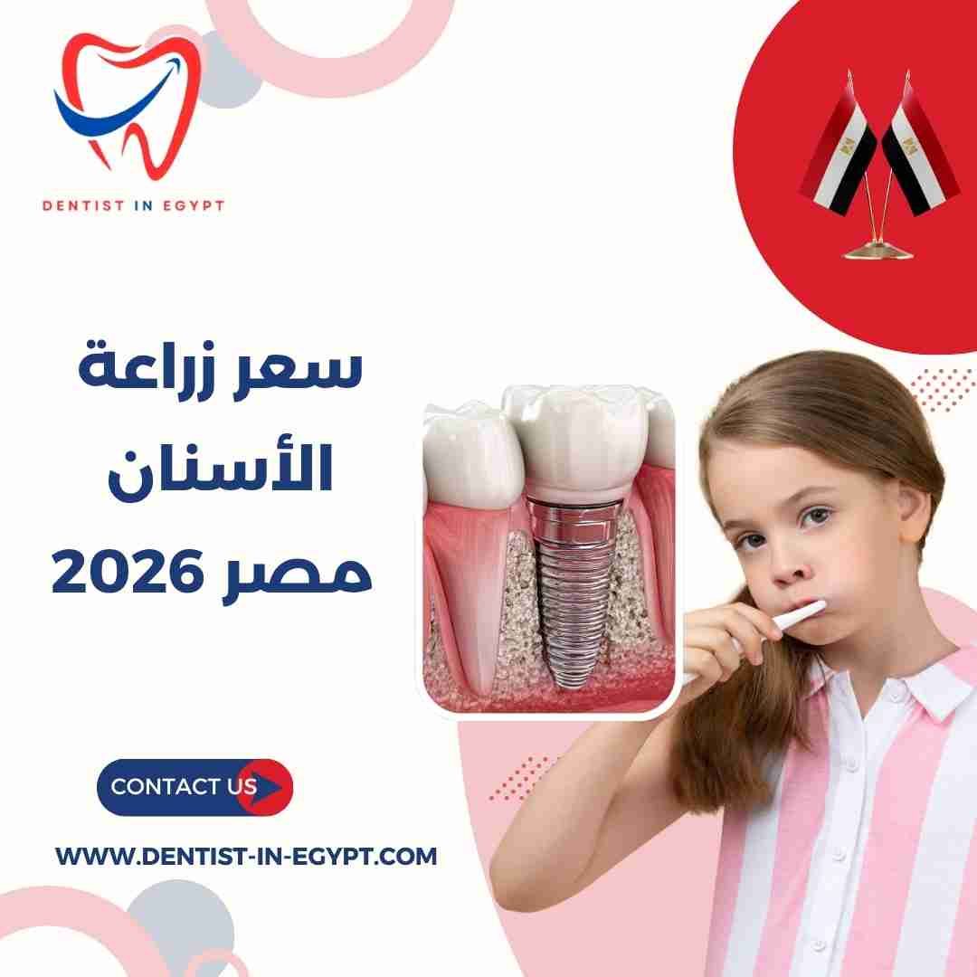 سعر زراعة الأسنان في مصر 2026