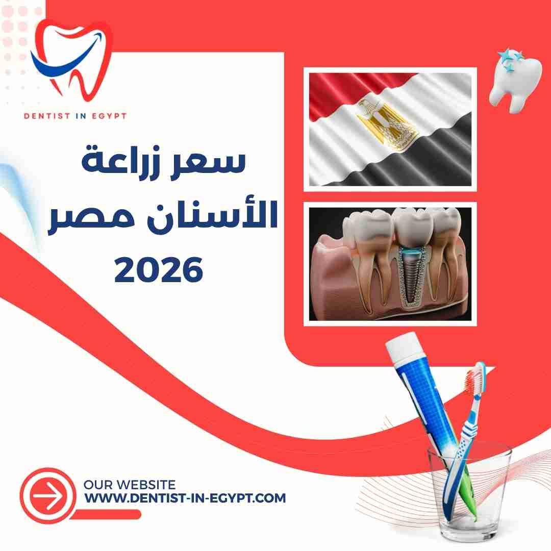 سعر زراعة الأسنان في مصر 2026