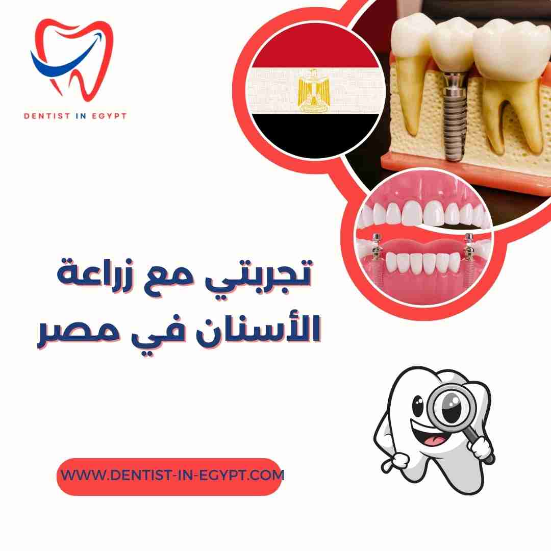 تجربتي مع زراعة الأسنان في مصر
