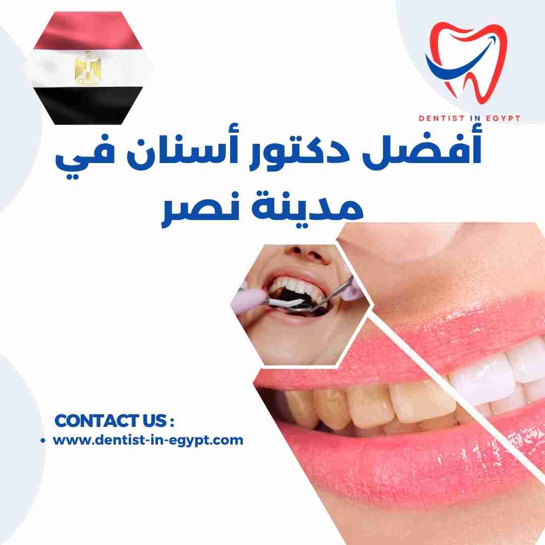 أفضل دكتور أسنان في مدينة نصر