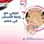 تجربتي مع زراعة الأسنان في مصر