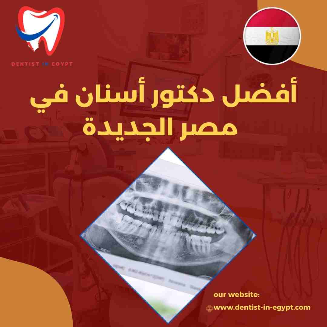 أفضل دكتور أسنان في مصر الجديدة
