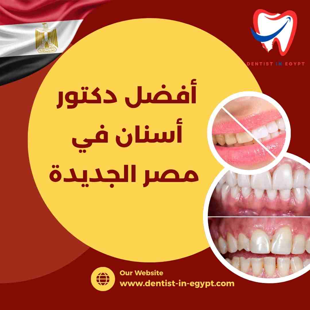 أفضل دكتور أسنان في مصر الجديدة