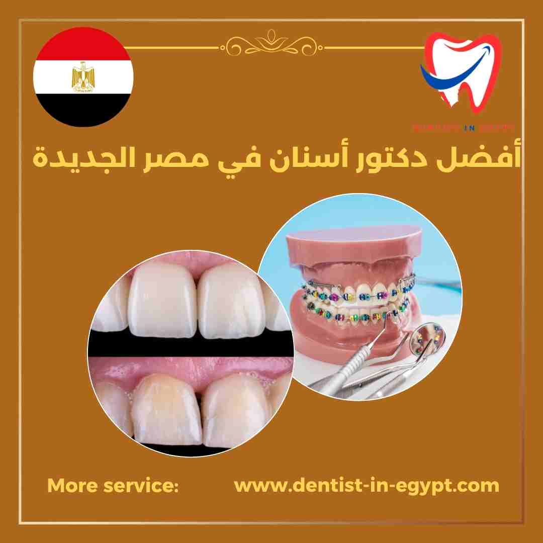 أفضل دكتور أسنان في مصر الجديدة