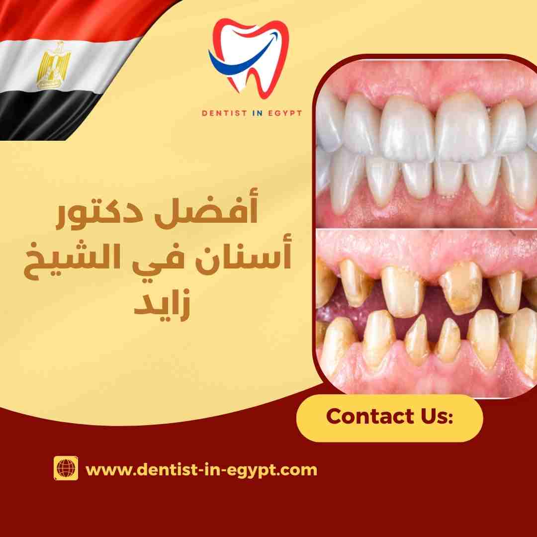 أفضل دكتور زراعة أسنان في الشيخ زايد