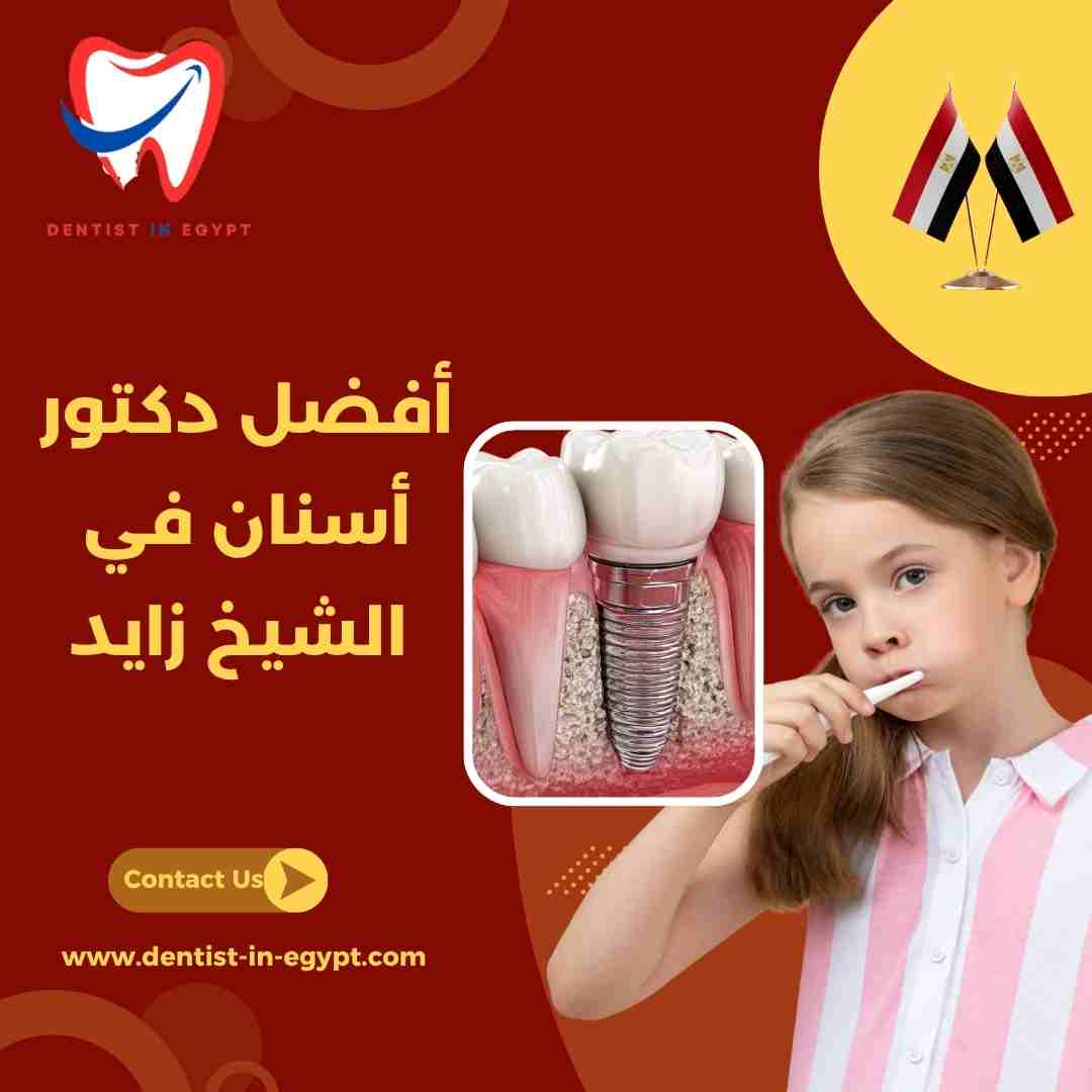 أفضل دكتور زراعة أسنان في الشيخ زايد