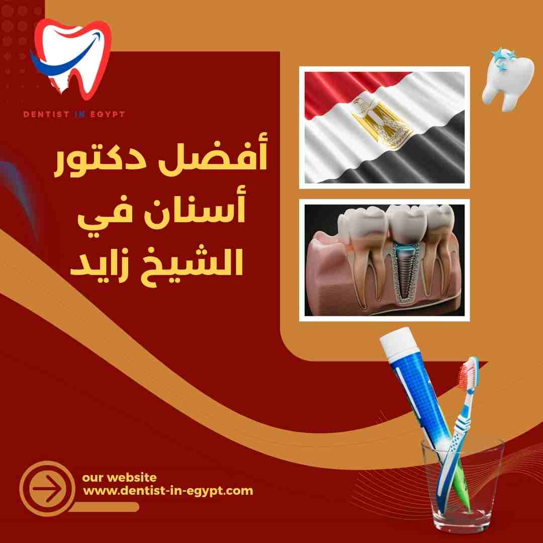 أفضل دكتور زراعة أسنان في الشيخ زايد