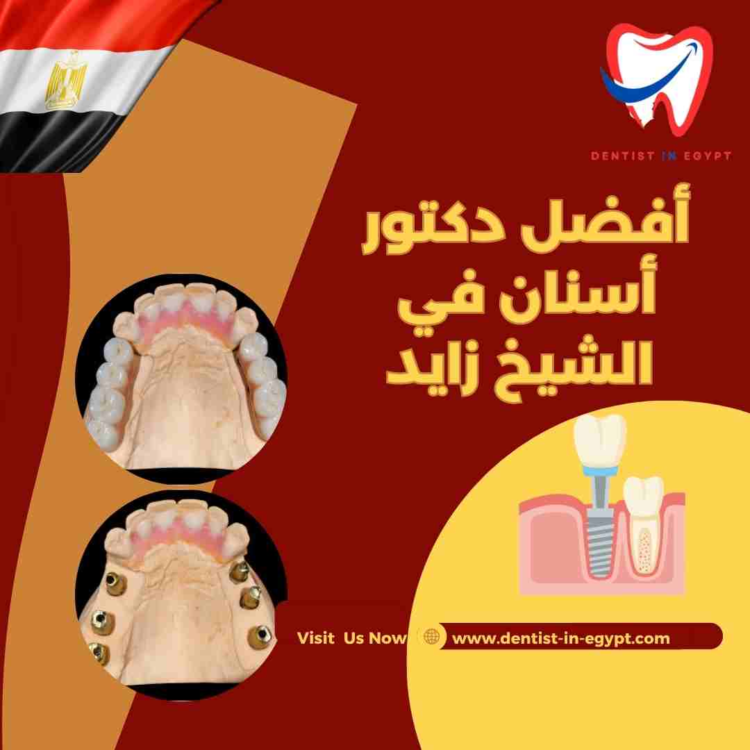أفضل دكتور زراعة أسنان في الشيخ زايد