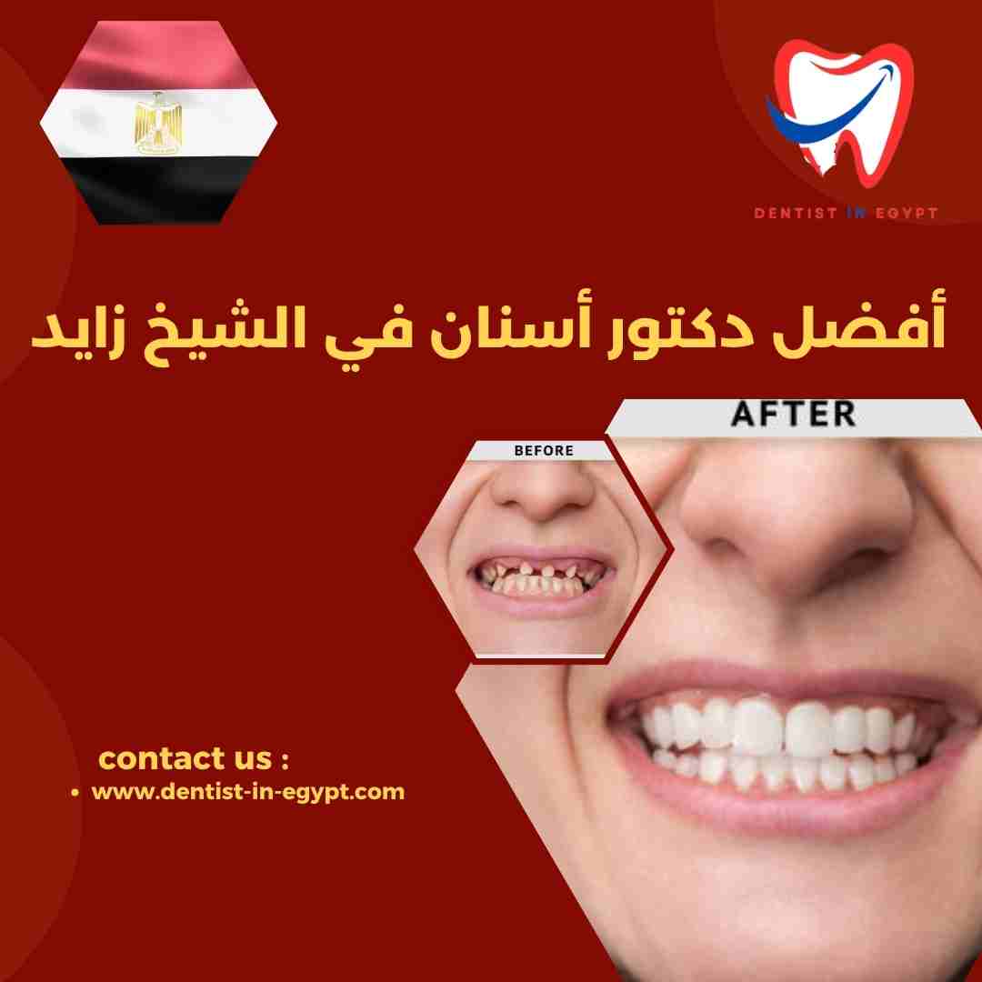 أفضل دكتور زراعة أسنان في الشيخ زايد