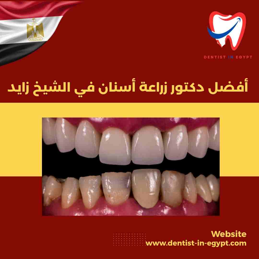 أفضل دكتور أسنان في الشيخ زايد
