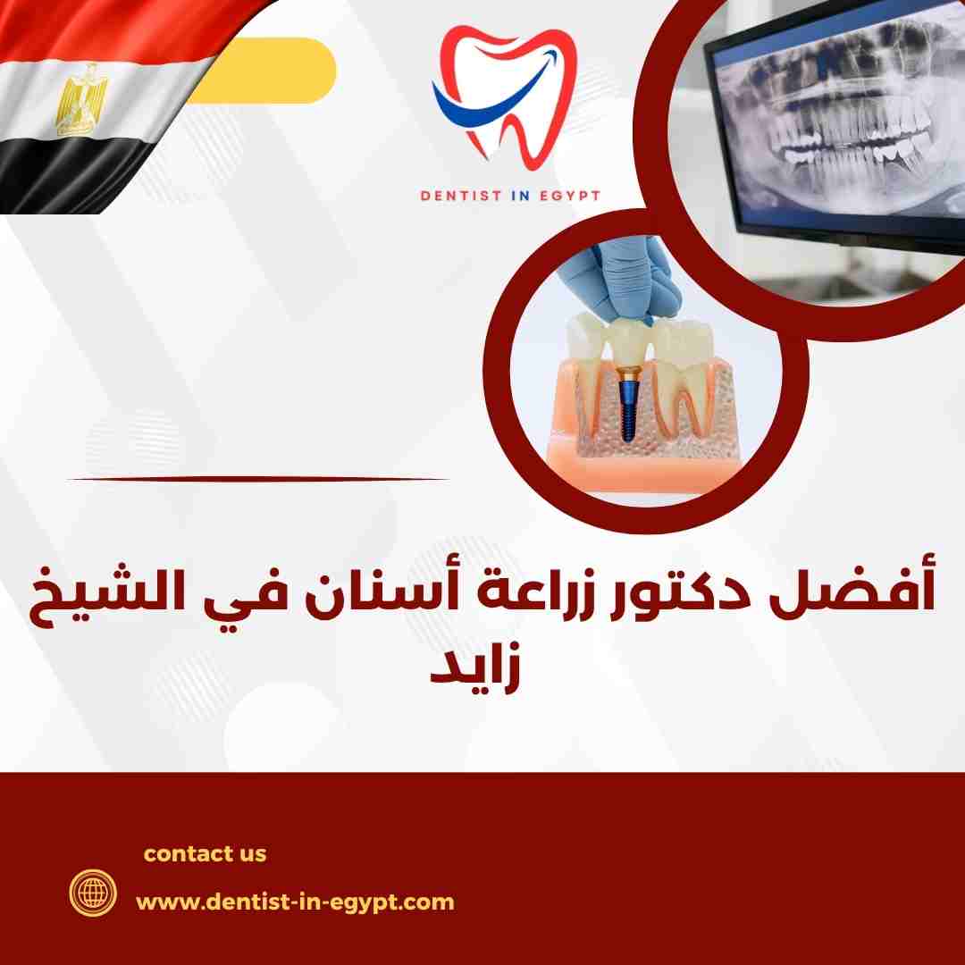 أفضل دكتور أسنان في الشيخ زايد